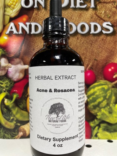 Acne & Rosacea Herbal Extract 4 oz